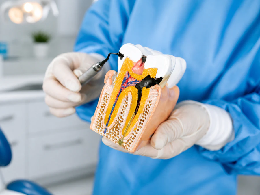 A dentist in blue gloves showing a cross-section model of a tooth